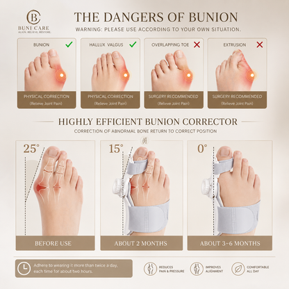 Pain Relief Bunion Toe Corrector - (IMPORTED W/O KNOB)