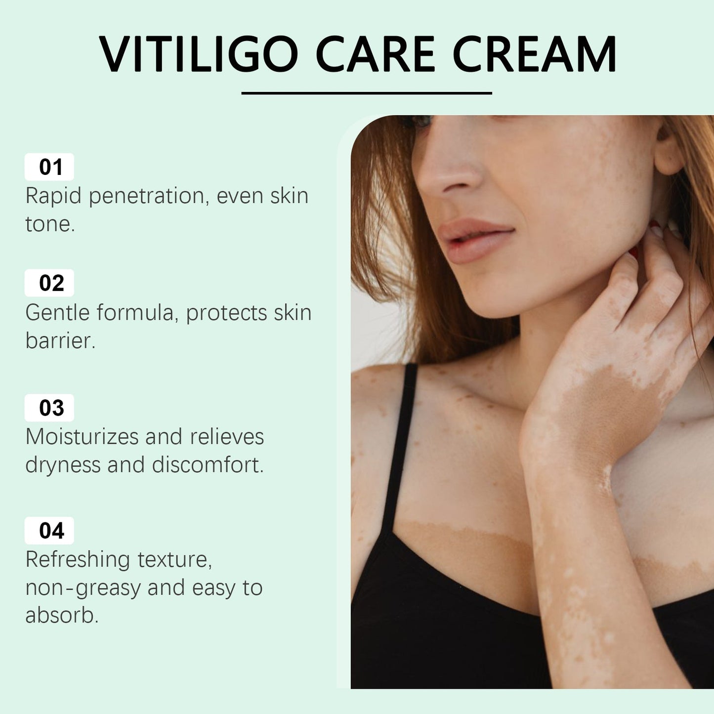 Vitiligo Herbal Aloe Vera & Mint Care Cream