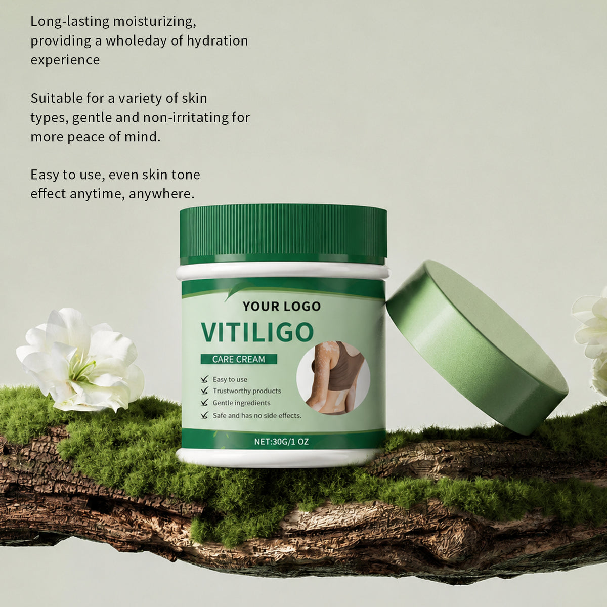 Vitiligo Herbal Aloe Vera & Mint Care Cream